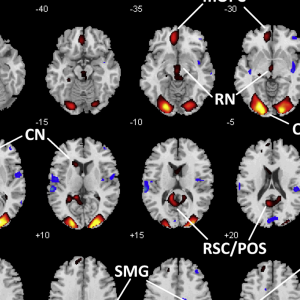 A series of brain scans presented in a grid format, showing axial views of the brain with various regions highlighted. The images feature labels indicating specific areas, such as RN, C, CN, RSC/POS, and SMG. Regions of interest are marked in red and yellow, indicating increased activity, while areas in blue suggest decreased activity. The numerical values on the left represent the z-coordinates in millimeters, indicating different brain slices. The overall image illustrates functional areas or changes in brain activity in a scientific context