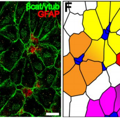 A two-panel image. The left panel displays a fluorescence microscopy image labeled with βcat/ytub in green and GFAP in red, showing a network of cells with a dark background. The right panel features a color-coded diagram with various irregular shapes filled with colors like yellow, orange, blue, pink, and white, possibly representing different cell types or regions. A scale bar is visible in the left panel